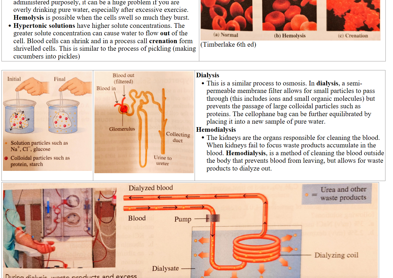 Hypotonic solutions have a lower solute concentration and result in fluid flowing into the cell. Although this is sometimes administered purposely, it can be a huge problem if you are overly drinking pure water, especially after excessive exercise. Hemolysis is possible when the cells swell so much they burst.
Hypertonic solutions have higher solute concentrations. The greater solute concentration can cause water to flow out of the cell. Blood cells can shrink and in a process call crenation form shrivelled cells. This is similar to the process of pickling (making cucumbers into pickles)
out-BYscVxHK.jpeg Isotomc 
solution 
(a) Normal 
Hypotonic 
solution 
(b) Ilemolysis 
Hypertonic 
solution 
(c) Crenation 
(Timberlake 6th ed)

pro-C94hkDSR.jpeg Initial 
Final 
Solution particles such as 
Na , Cl¯, glucose 
O Colloidal particles such as 
protein, starch 
pro-RedPxU7s.jpeg Blood out 
(filtered) 
Blood in 
Glomerulus 
I Collecting 
duet 
Ufine to 
ureter 
Dialysis 
This is a similar process to osmosis. In dialysis, a semi-￼permeable membrane filter allows for small particles to pass ￼through (this includes ions and small organic molecules) but ￼prevents the passage of large colloidal particles such as ￼proteins. The cellophane bag can be further equilibrated by ￼placing it into a new sample of pure water.
Hemodialysis 
The kidneys are the organs responsible for cleaning the blood. ￼When kidneys fail to focus waste products accumulate in the ￼blood. Hemodialysis, is a method of cleaning the blood outside ￼the body that prevents blood from leaving, but allows for waste ￼products to dialyze out.

pro-RDYO7NUm.jpeg Machine generated alternative text:
Dialyzed blood 
Pump -—4 
Dialysate 
During dialysis, waste products and excess 
water are removed from the blood. 
Urea and other 
waste products 
Dialyzing coil 
